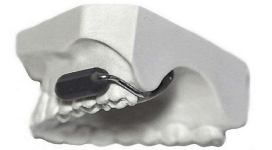 Pentagon field tests ‘molar mic,’ an encrypted radio that attaches to your tooth