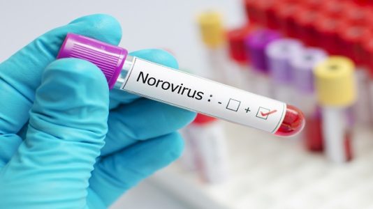 If you have a ‘stomach flu,’ chances are it’s actually norovirus: What you should know
