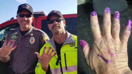 Utah firefighters calm girl in car accident with nail polish