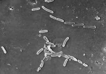 FILE - This scanning electron microscope image made available by the Centers for Disease Control and Prevention shows rod-shaped Pseudomonas aeruginosa bacteria. U.S. health officials are advising people to stop using the over-the-counter eye drops, EzriCare Artificial Tears, that have been linked to an outbreak of drug-resistant infections of Pseudomonas aeruginosa. The Centers for Disease Control and Prevention on Wednesday night, Feb. 1, 2023, sent a health alert to physicians, saying the outbreak includes at least 55 people in 12 states. One died. (Janice Haney Carr/CDC via AP)