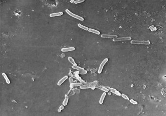 FILE - This scanning electron microscope image made available by the Centers for Disease Control and Prevention shows rod-shaped Pseudomonas aeruginosa bacteria. Experts are marveling at how U.S. disease detectives figured out how eyedrops were linked to dozens of infections. (Janice Haney Carr/CDC via AP)
