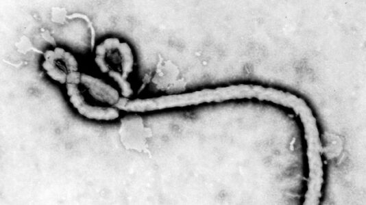 US doctor infected with Ebola critically ill but says he is ‘cautiously optimistic’